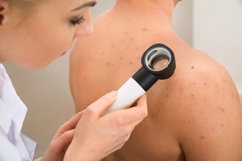 Imagem ilustrativa do artigo Acne fúngica: o que é, sintomas e tratamento (é contagiosa?)