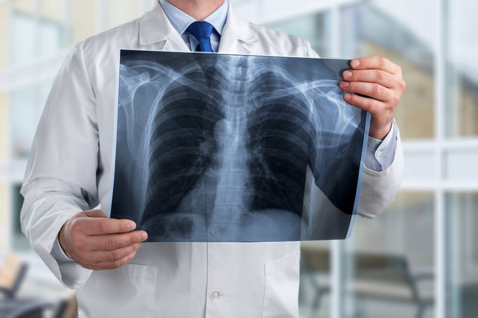 médecin en train d'examiner une radiographie pulmonaire