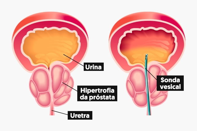 Imagem ilustrativa número 1