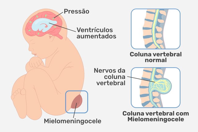 Imagem ilustrativa número 1