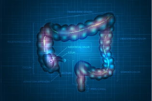 Imagen ilustrativa del artículo  Cáncer de ano: qué es, síntomas y tratamiento