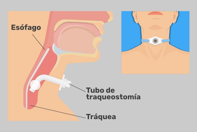 Imagem ilustrativa número 1