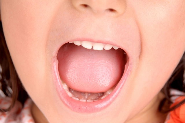 kid with wide open mouth showing baby teeth