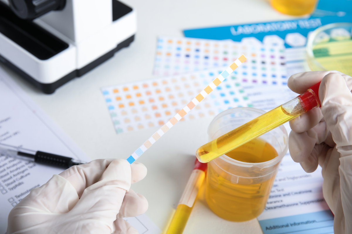 Esterase leucocitária: o que é (e o que significa estar positivo) - Tua ...
