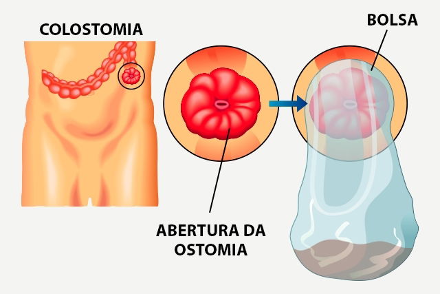 Imagem ilustrativa número 1