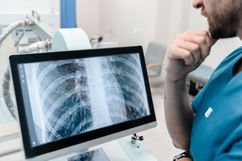 Imagen ilustrativa del artículo 8 síntomas de tuberculosis (pulmonar y extrapulmonar)