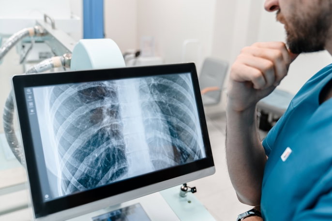 Médico analizando rx de tuberculosis
