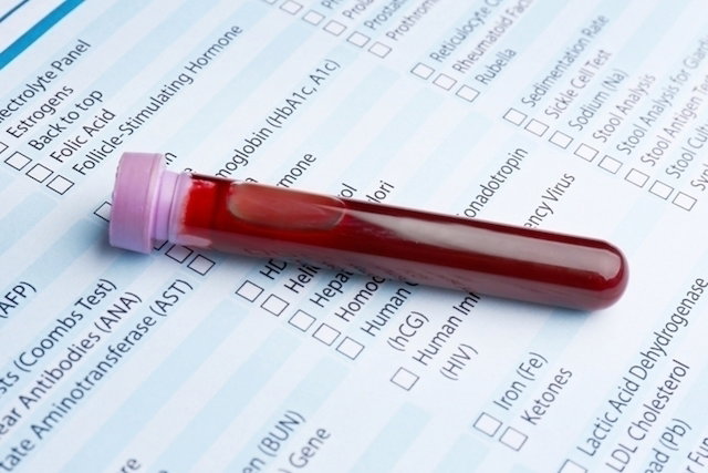 tube of blood on a requisition form