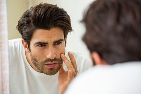 Illustrative image of the article Ingrown Beard Hair: Symptoms, Causes & Treatment