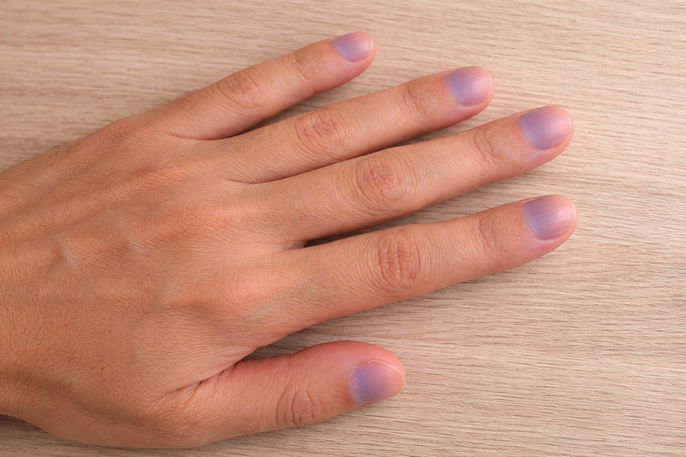 Purple nails beds | AI-generated image