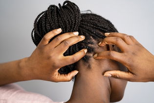 Illustrative image of the article Scalp Tingling: 7 Common Causes & What to Do