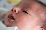 Illustrative image of the article Tiny Bumps on Baby Skin: 5 Causes & What to Do (w/ Photos)