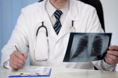 Imagem ilustrativa do artigo Pneumonia: o que é, sintomas, tipos, causas e tratamentos