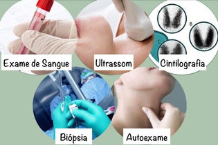 Illustrative image of the article Thyroid Tests: 9 Tests That Assess Thyroid Functioning