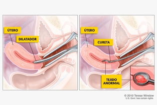 Imagen ilustrativa del artículo Legrado (curetaje): qué es, cómo se realiza y dudas comunes