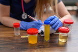 Imagen ilustrativa del artículo Proteinuria: qué es, causas, tratamiento y valores