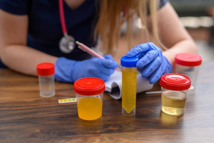 Bioquímica realizando análisis de orina
