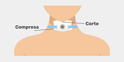 Imagen ilustrativa del artículo Traqueostomía: qué es, para qué sirve y cuidados