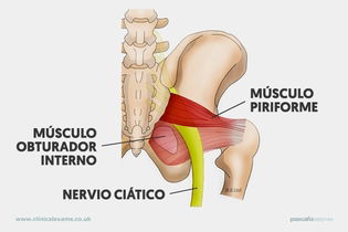 Imagen ilustrativa del artículo Síndrome piramidal: síntomas y tratamiento