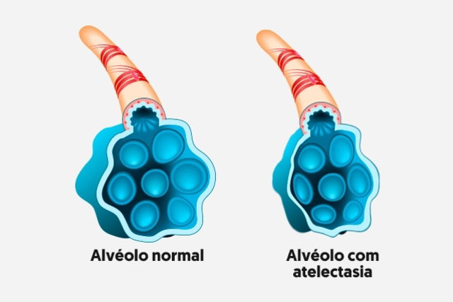 Imagem ilustrativa número 1