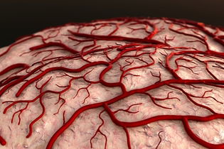 Imagem ilustrativa do artigo O que é Angioma venoso, Sintomas e Tratamento