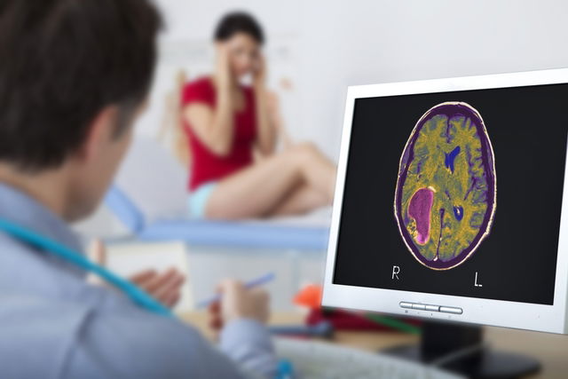 S Ntomas Generales Y Espec Ficos De Un Tumor Cerebral Tua Sa De