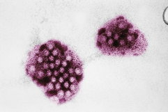 Imagen ilustrativa del artículo Norovirus: qué es, síntomas y tratamiento
