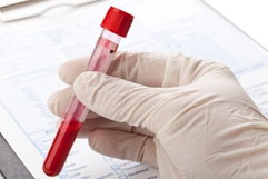 Illustrative image of the article ESR Blood Test: What It Is & What Results Mean