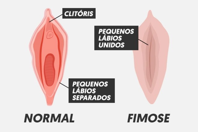 Imagem ilustrativa número 2