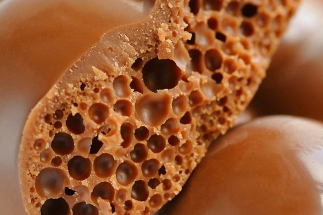 Trypophobia What Causes It Common Triggers Treatment Tua Sa de Trypophobia What Causes It Common Triggers Treatment Tua Sa de