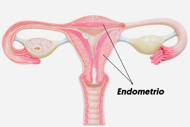 Zona de aumento del grosor de tejido endometrial