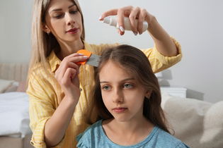 Illustrative image of the article Home Remedies for Lice: 4 Natural Products to Use