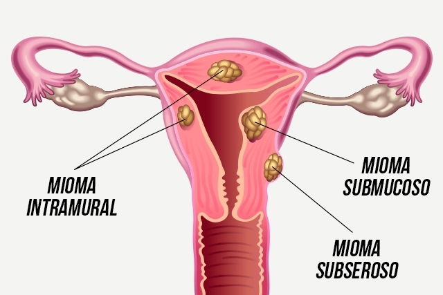 Imagem ilustrativa número 1