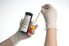 Illustrative image of the article Hemoglobin in Urine: What It Means & When to Worry