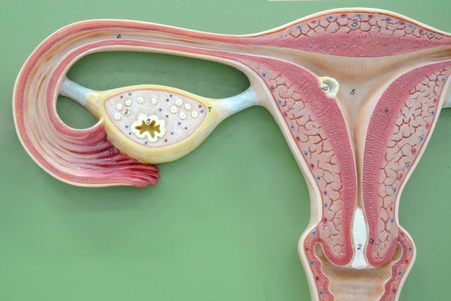 Imagen ilustrativa del artículo Ovario poliquístico: qué es, síntomas y tratamiento