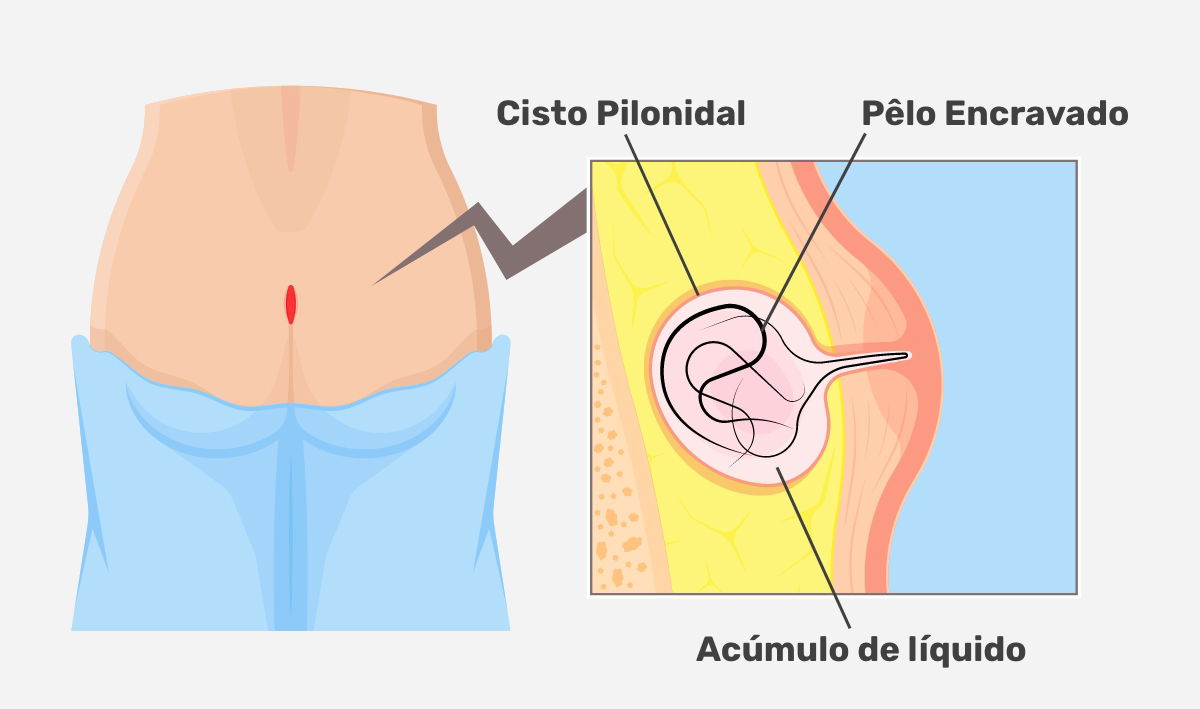 Imagem ilustrativa número 1