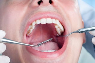 Illustrative image of the article Bump on the Roof of the Mouth: 9 Causes (& What to Do)