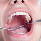 Illustrative image of the article Bump on the Roof of the Mouth: 9 Causes (& What to Do)