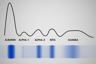 Imagen ilustrativa del artículo Electroforesis de proteínas: para qué sirve y resultados