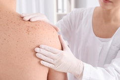 Illustrative image of the article Are all warts caused by HPV?
