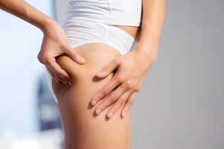 Image illustrative de l'article Comment enlever la cellulite: 10 conseils efficaces