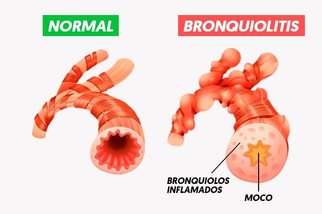 Imagem ilustrativa número 1