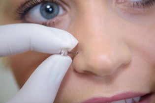 Illustrative image of the article Infected Piercing: Symptoms, Aftercare & Ointment