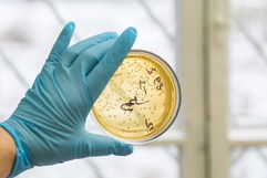 Image illustrative de l'article Staphylocoque doré: c'est quoi, symptômes et traitement 