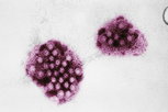 Imagen ilustrativa del artículo Norovirus: qué es, síntomas y tratamiento